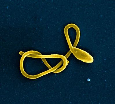 Regeneron的Inmazeb成为首个获得FDA批准的埃博拉病毒治疗药物