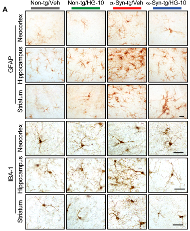 Sci Transl Med：<font color="red">LRRK2</font>通过NFATc<font color="red">2</font>介导突触核病的小胶质细胞神经毒性