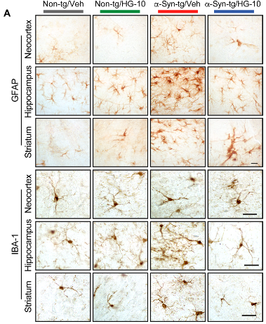 Sci Transl Med：LRRK2通过NFATc2介导突触<font color="red">核</font>病的小胶质细胞神经毒性
