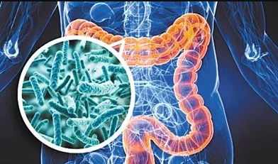 <font color="red">IBD</font>: 炎症性肠病患者接受胃肠外科手术会持续降低微生物组的多样性