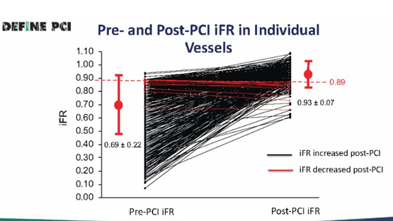 TCT 2020丨DEFINE-PCI研究：PCI<font color="red">术后</font>残余缺血患者的1年结局