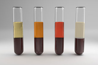 IBD: 血清二肽基肽酶4是一种新的<font color="red">炎症</font>性<font color="red">肠</font><font color="red">病</font>疾病活动和预后的预测指标