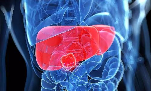 J Gastroenterology：<font color="red">蛋白质</font>组学分析确定TPI1是预测肝内胆管癌复发的新型生物标志物