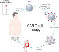 FDA暂停CAR-T疗法UCARTCS1治疗多发性骨髓瘤的临床试验
