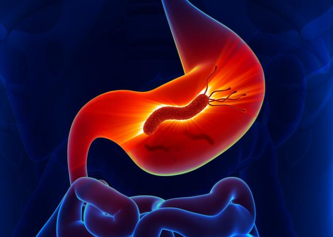 <font color="red">Gastric</font> Cancer: 非伤寒沙门氏菌病在胃癌中的潜在作用