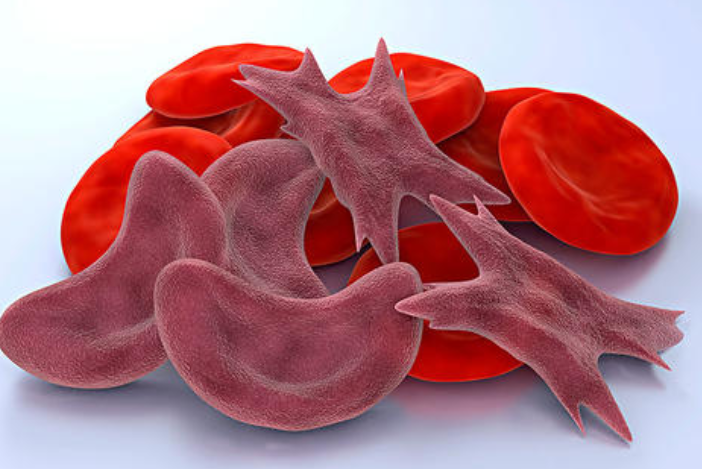 Blood：血红色可抑制SCD患者的体液B细胞反应调控同种免疫风险