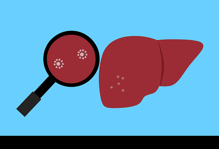 Gut：肠道中与肠易激综合征(IBS)有关的特殊细菌
