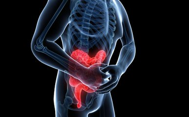 AP&T: 5-氨基水杨酸盐不耐受的溃疡性结肠炎患者接受结肠切除术的风险增加
