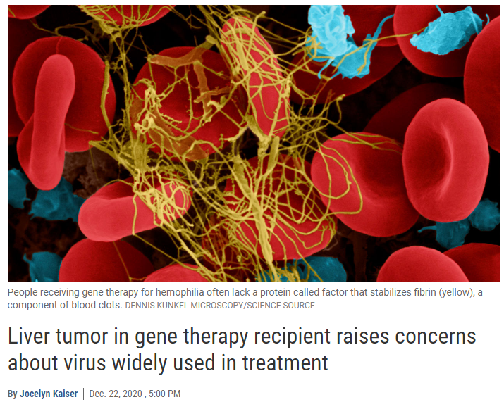 Science：最“安全”<font color="red">基因</font>治疗载体似乎并不安全，血友病患者接受治疗后患上肝癌