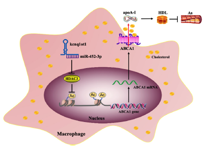 Cell Death Dis：LncRNA kcnq1ot1通过介导miR-452-3p/<font color="red">HDAC</font>3/ABCA1通路促进脂质的积累并促进动脉粥样硬化