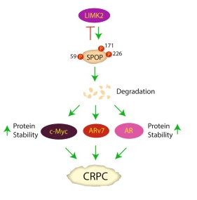 Br J Cancer：LIMK2介导的<font color="red">SPOP</font>磷酸化降解促进去势抵抗性前列腺癌的发生发展