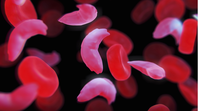 CRISPR-Cas9技术可在<font color="red">人体实验</font>中有效治疗镰状细胞贫血和β-地中海贫血