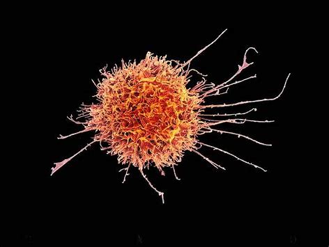 NK细胞接合剂（TriKE™）治疗乳腺癌和胃肠道癌症