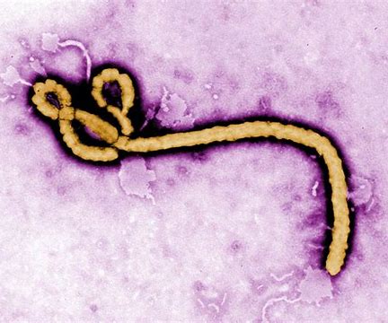 埃博拉病毒治疗药物ansuvimab-zykl已获得FDA批准