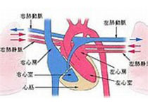 不<font color="red">同情</font>况下成人体外膜肺氧合临床应用专家共识（2020）