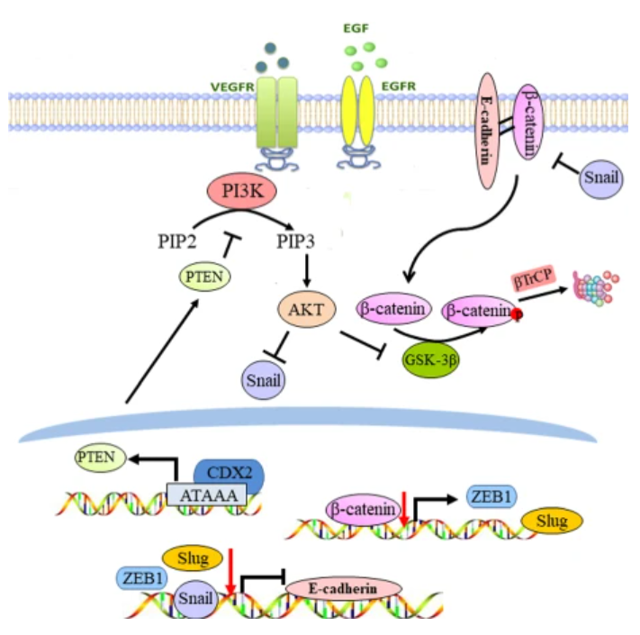 Br J Cancer：CDX2调节<font color="red">Snail</font>的表达和β-catenin的稳定性抑制结直肠癌的侵袭和转移