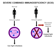 ASH 2020：抗CD117单克隆抗体JSP191用于治疗严重联合免疫<font color="red">缺陷</font>病（SCID）