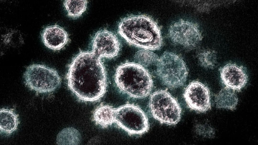 MedRxiv: 新冠病毒可在部分物体表面存活3天，轻度感染者10天后或已不具有传染性