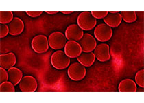 Thorax：早产年轻人新生儿期<font color="red">吸氧</font><font color="red">时间</font>、红细胞生成和血压的关系