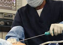 JAMA Cardiol：老年晚期心衰患者中与植入式心脏复律除颤器相关的围手术期风险和生存率