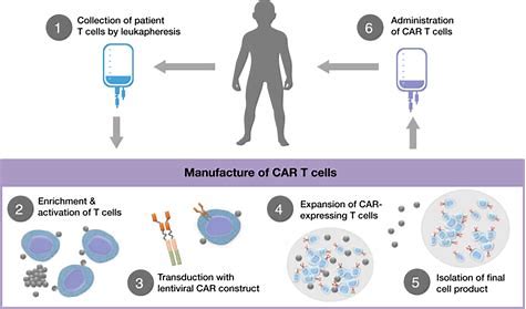 CAR-T细胞免疫疗法（idecabtagene vicleucel）治疗<font color="red">多发性</font>骨髓瘤