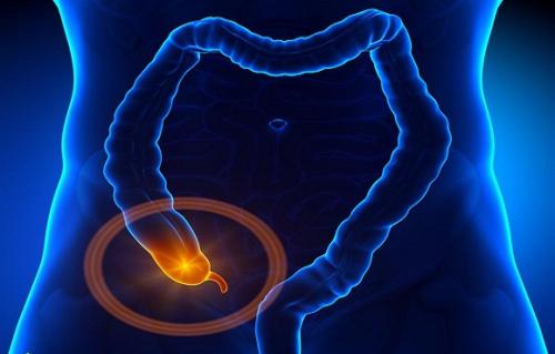 Gastroenterology：粪便中硫代谢细菌群落与男性远端结直肠癌风险之间的关联 