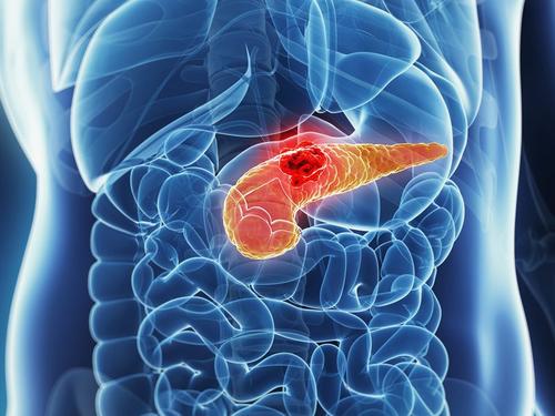 Gastroenterology：二苯基丁基哌啶抗精神病药物可以减少小鼠胰腺导管腺癌的生长 