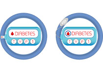 Diabetologia：臍帶<font color="red">血</font>代謝標(biāo)志物是孕產(chǎn)婦肥胖對(duì)妊娠期胎兒生長(zhǎng)影響的強(qiáng)有力的調(diào)節(jié)物