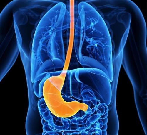 JGH OPEN： 给食管静脉曲张患者放置肠管出现消化道出血的风险因素 