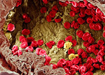 Blood：衰老诱导的<font color="red">IL</font><font color="red">27</font>Ra信号可损伤造血干细胞