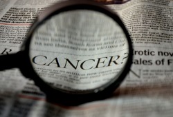 Med Sci Monit：KIF<font color="red">18</font>A的表达与前列腺癌的肿瘤分期和细胞增殖相关