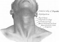 Otolaryngol Head Neck Surg：非对称性听力损失人工耳蜗植入者的双模听力的主观益处 