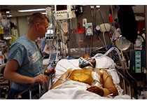 Circulation：COVID-19住院患者深静脉血栓形成的患病率、危险因素和结局