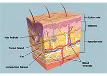 NEJM：罗氟司特乳膏局部治疗可显著改善银屑病患者皮肤症状