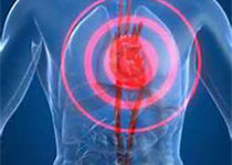 Circulation：心肌损伤、亚临床炎症标志与猝死风险