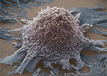 PNAS：加利福尼亚大学开发利用“合成致死作用”靶向癌症的新方法