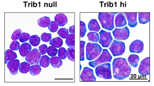 Blood：Trib1通过调节Hoxa9的转录来促进AML进展