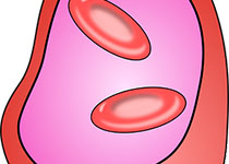 JASN：补充维生素<font color="red">K</font>可改善CKD患者血管僵硬度吗？