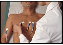 JAHA：顽固性高血压患者难治性高血压与心血管事件和死亡风险