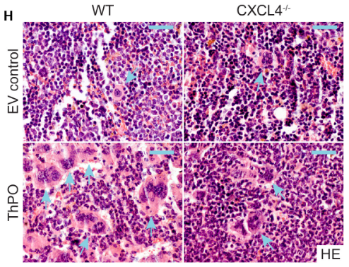 Blood：造血细胞高表达CXCL4促进<font color="red">MPN</font>骨髓纤维化进展