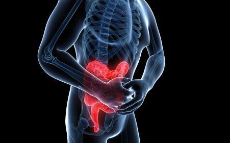Clin Gastroenterology H：轻中度溃疡性结肠炎患者的临床表现与粘膜炎症之间的不一致