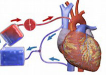 JAMA Cardiol ：<font color="red">高</font><font color="red">敏</font>肌钙蛋白有助于评估心血管病风险