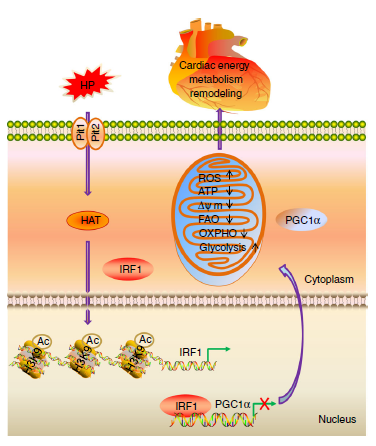 Nat Commun：IRF1-PGC1α通路对4型心肾综合征的贡献