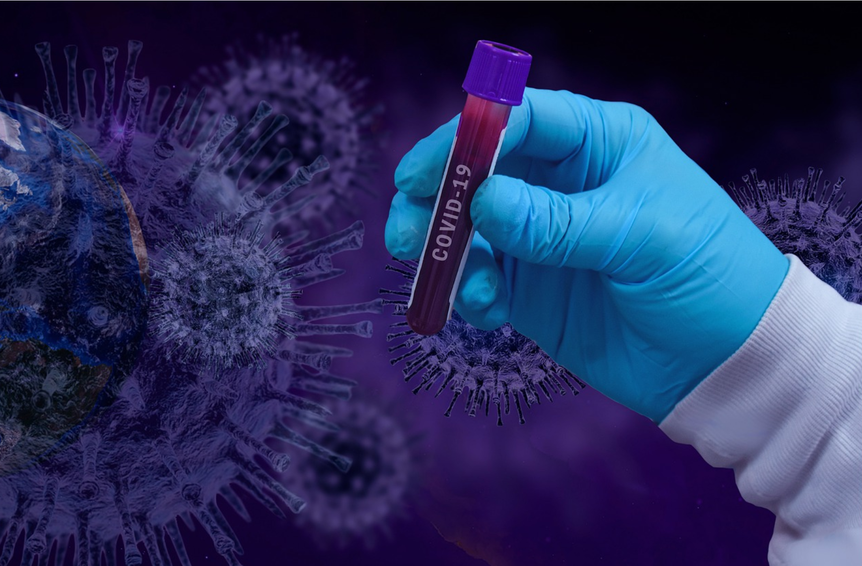 NEJM：冰岛对SARS-CoV-2<font color="red">体液</font>免疫应答的研究成果可喜