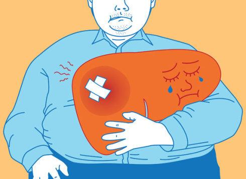 World J Gastroenterology: 营养状况和营养支持在乙型肝炎病毒相关的慢性慢性肝衰竭中的作用