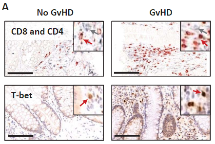 Blood：维甲酸反应性CD8效应T细胞在胃肠<font color="red">GvHD</font>富含IL-23的组织中选择性扩增