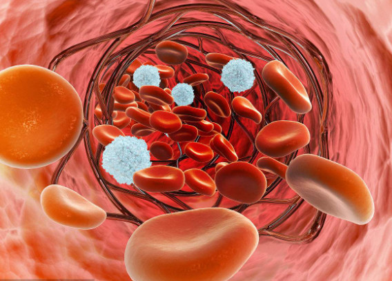 J Gastroenterology：炎症性肠病患者动静脉<font color="red">血栓</font>栓塞导致的死亡率和风险因素分析