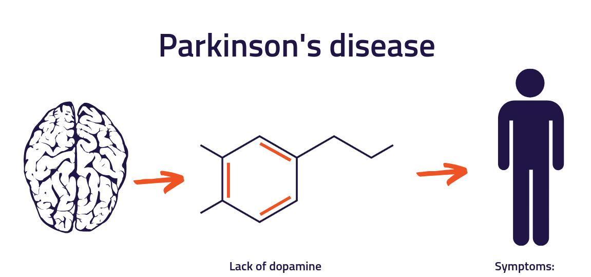 帕金森药物MLR-1019已开始量产，用于IIa期临床试验