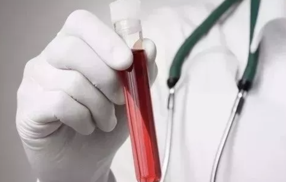 关于血液的这些特殊检查，你们<font color="red">医院</font><font color="red">都</font>开展吗?