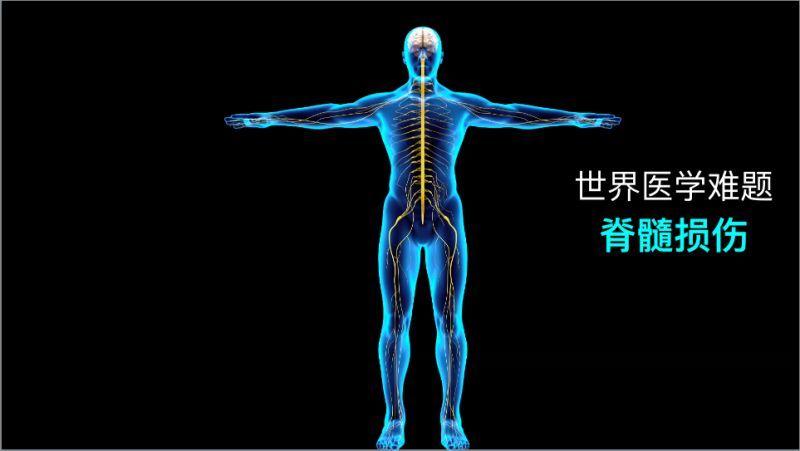 JNER：脊髓损伤患者上肢功能和运动学之间的关系